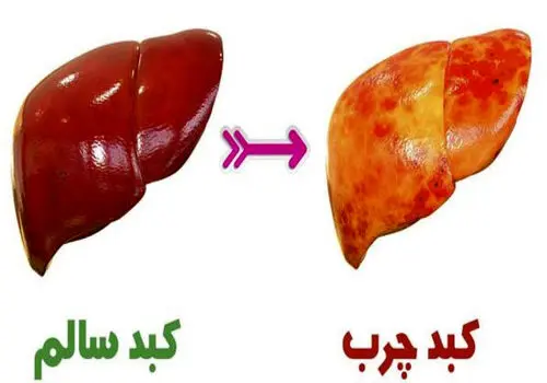 با این ۵ خوراکی، هوس شکر نمی‌کنید