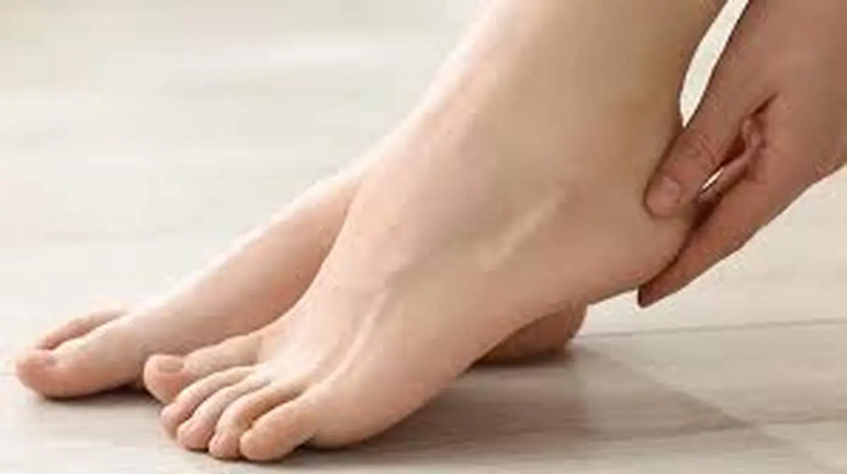 ماندن رد کش جوراب بر روی پا چه دلیلی دارد؟