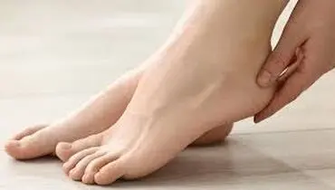 ماندن رد کش جوراب بر روی پا چه دلیلی دارد؟
