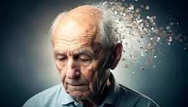 چه رابطه ای بین هنرمندان و ابتلا به آلزایمر وجود دارد؟
