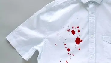 چطور لکه‌های سرسخت لبو را از لباس محو کنیم؟