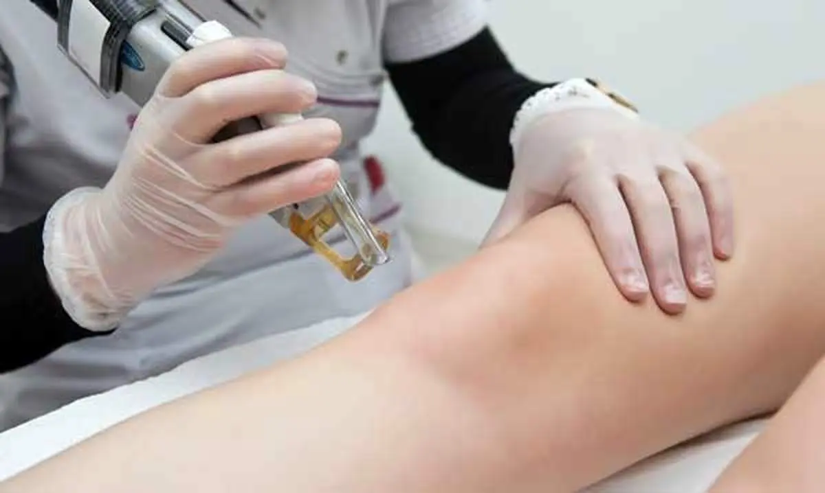 لیزر موهای زائد بدن برای چه افرادی مناسب نیست ؟