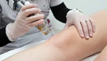 لیزر موهای زائد بدن برای چه افرادی مناسب نیست ؟
