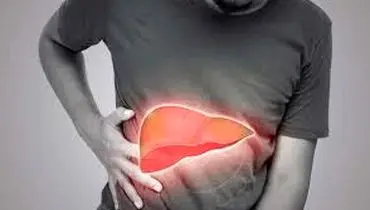 علائم کبد چرب چیست؟
