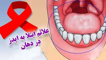 نشانه های بیماری ایدز در دهان چیست؟
