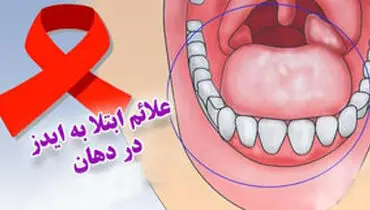 نشانه های بیماری ایدز در دهان چیست؟
