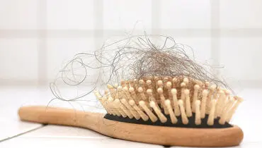 دلایل ریزش مو در زنان چیست؟