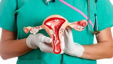 اگر تخمدان پلی‌کیستیک دارید، این تمرین‌ها را از دست ندهید!

