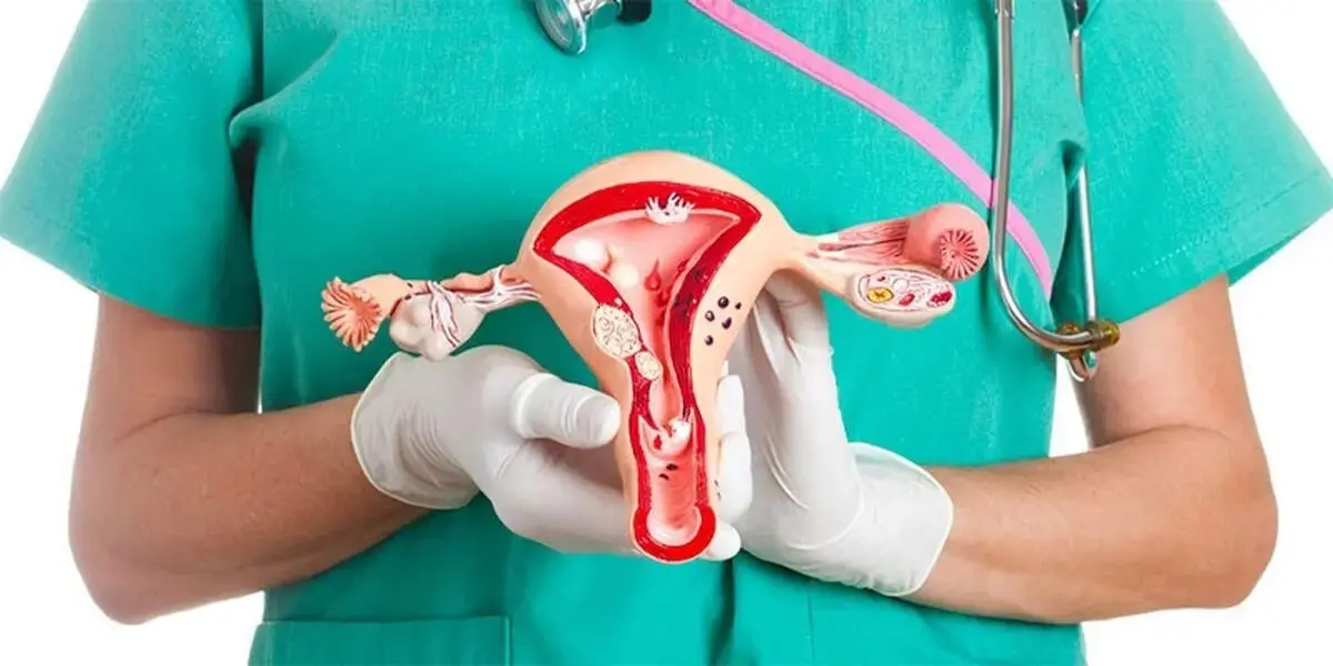 اگر تخمدان پلی‌کیستیک دارید، این تمرین‌ها را از دست ندهید!

