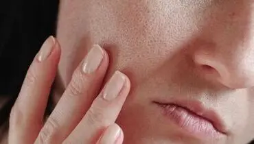 چگونه در فصل سرد از پوست مراقبت کنیم؟