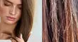 چگونه از موخوره جلوگیری کنیم؟