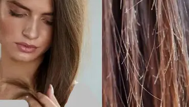 چگونه از موخوره جلوگیری کنیم؟