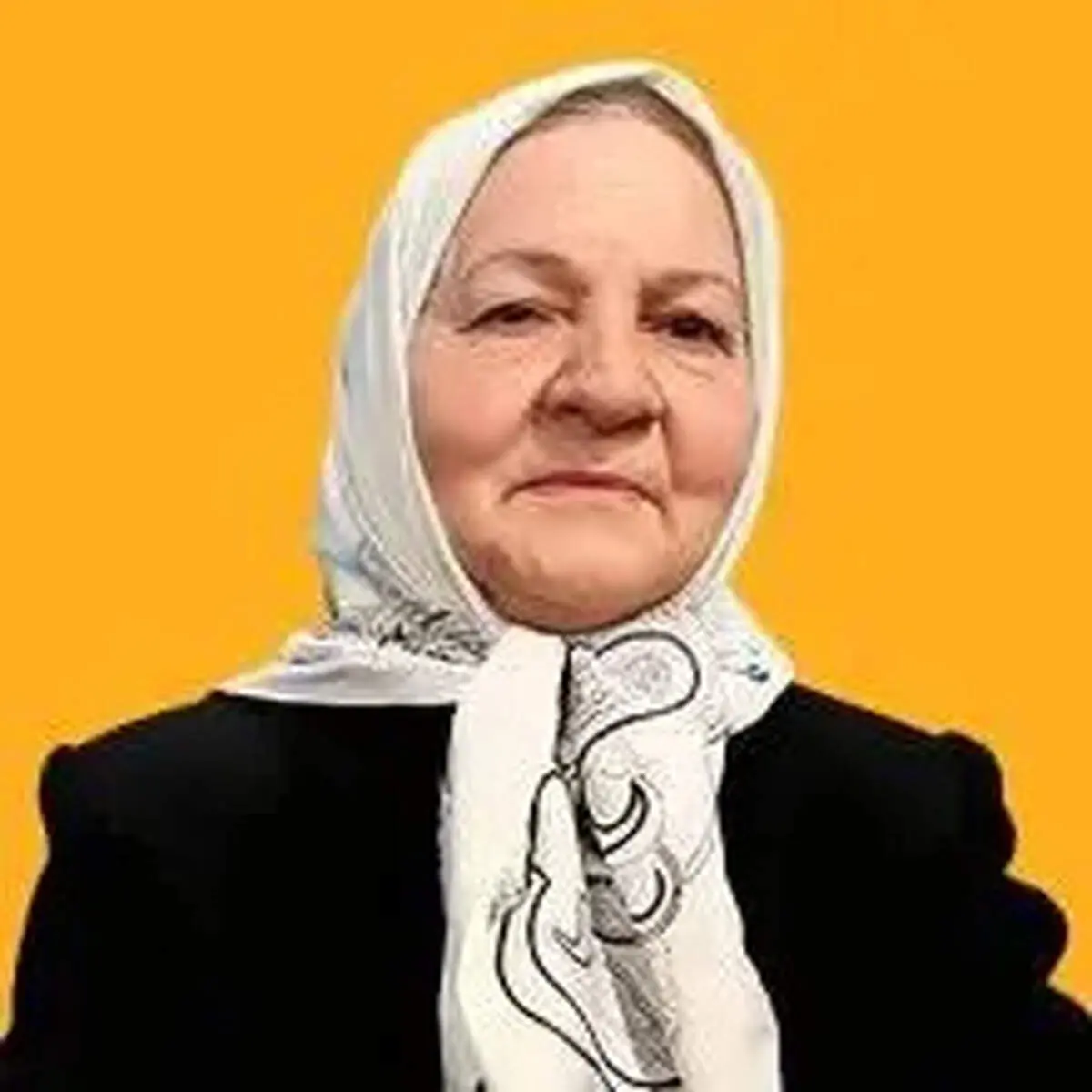 چهره متفاوت بازیگر «وضعیت سفید» پس از سال‌ها + فیلم