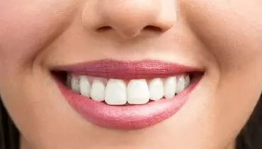 برای حفظ بهداشت دهان و دندان در ماه رمضان چه کنیم؟