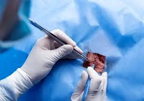 اعتراض صریح عضو شورای شهر کاشان به واگذاری سالن برای کنسرت: «برای منِ جانباز ننگ است+فیلم