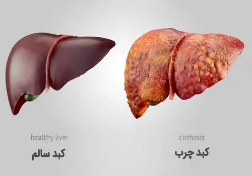 صبحانه مفید برای درمان کبد چرب
