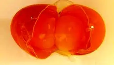  «کولین؛ ویتامین فراموش‌شده‌ای که مغز را جوان نگه می‌دارد»
