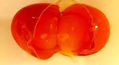  «کولین؛ ویتامین فراموش‌شده‌ای که مغز را جوان نگه می‌دارد»
