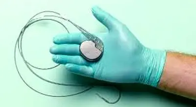 توصیه‌های مراقبتی پس از کاشت ضربان‌سازها