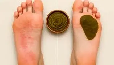 چرا حنا به کف پا بزنیم پا سیاه می شود؟
