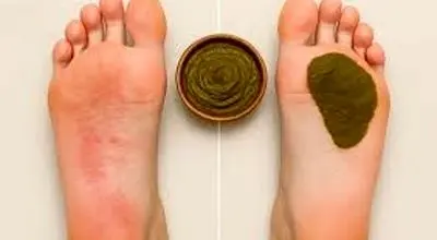 چرا حنا به کف پا بزنیم پا سیاه می شود؟

