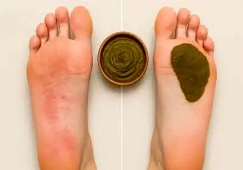 چرا حنا به کف پا بزنیم پا سیاه می شود؟
