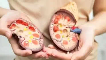 این غذاها کلیه‌ها را زنده نگه می‌دارند

