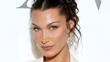 تصاویر دردناک مدل معروف ویکتوریا سکرت بعد از ابتلا به بیماری خطرناک + عکس