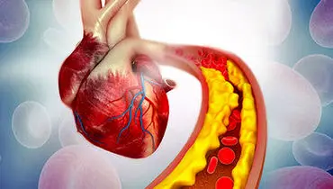 کاهش کلسترول خون با این ماده غذایی