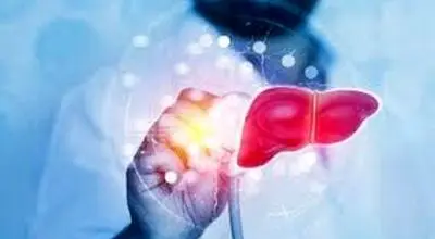 پنج علامت مهم ابتلا به کبد چرب که در ظاهر شما عیان می شود