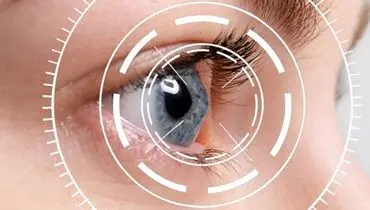 این افراد در خطر مبتلا شدن به زخم قرنیه هستند/ در این شرایط قطره بی حسی چشم نریزید!
