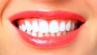 انقلاب در دندان‌پزشکی؛ ژل پروتئینی جدید مینای دندان را بازسازی می‌کند
