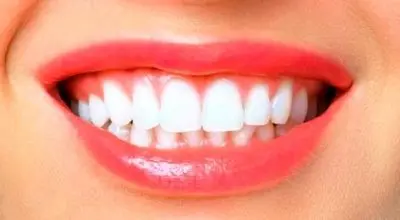 چرا دندان‌ها کج و کوله و نامرتب می‌شوند؟