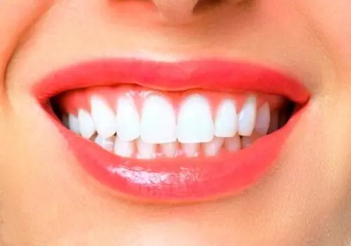مقابله با زخم های حاد دهانی با این چاشنی شگفت انگیز
