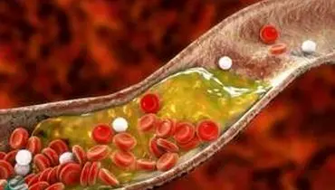 نوشیدنی‌های دم دستی برای پایین آوردن کلسترول را بشناسید