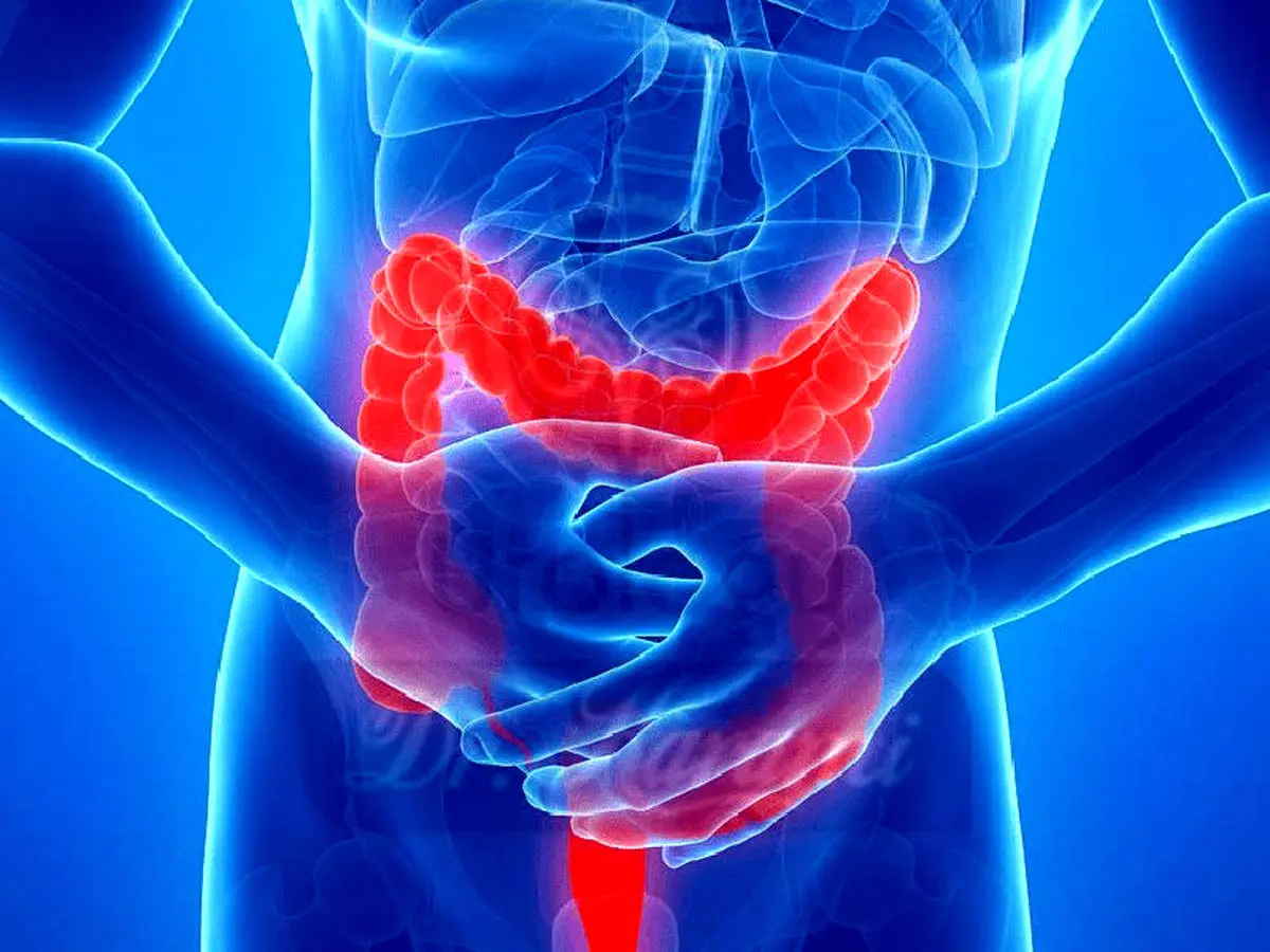 علائم خاموش بیماری‌های پروستات
