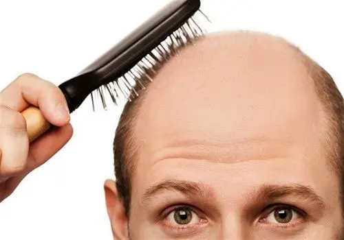درمانی ارزان و سریع برای جلوگیری از ریزش مو