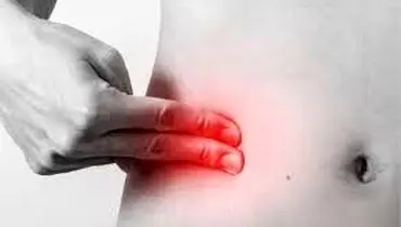 علت درد در اطراف ناف و شکم + راه های درمان
