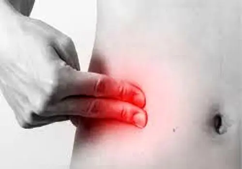 سردرد در ناحیه پیشانی و شقیقه ها
