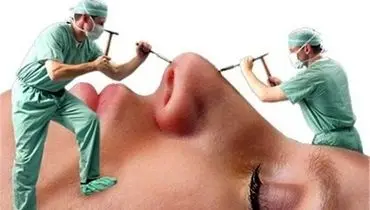 جراحی زیبایی، بلای جان نظام سلامت!