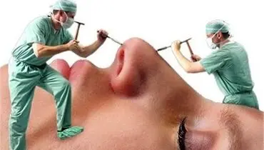 جراحی زیبایی، بلای جان نظام سلامت!
