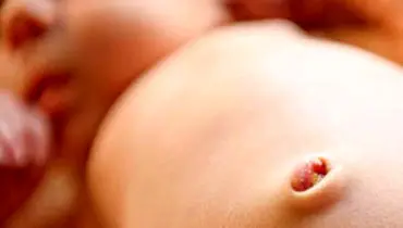 عفونت ناف می‌تواند خطرناک یا حتی مرگبار باشد
