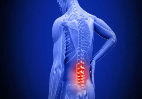 با رعایت این چند نکته ساده و بی‌هزینه دیسک کمر خود را درمان کنید