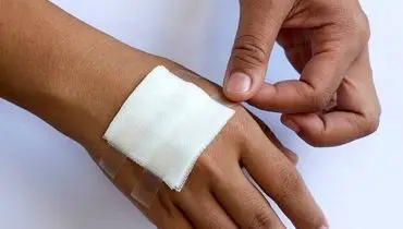 ساخت اسفنجی جدید در ایران که خونریزی رابه سرعت بند می‌آورد
