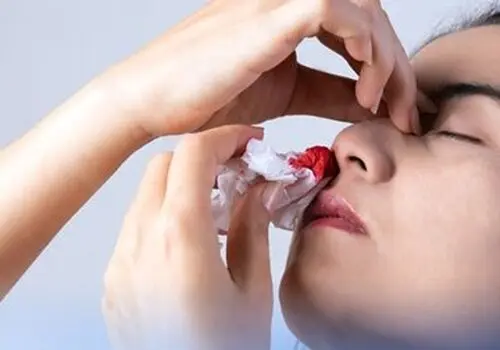 چگونه در جنگ خونریزی را کنترل کنیم؟