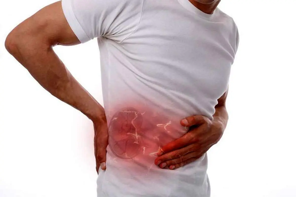 چطور درد کمر را با درد کلیه اشتباه نگیریم؟