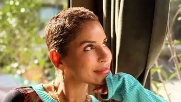 بازیگر مشهور ترکیه به سرطان مبتلاست