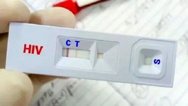 درمان «ایدز» رایگان است