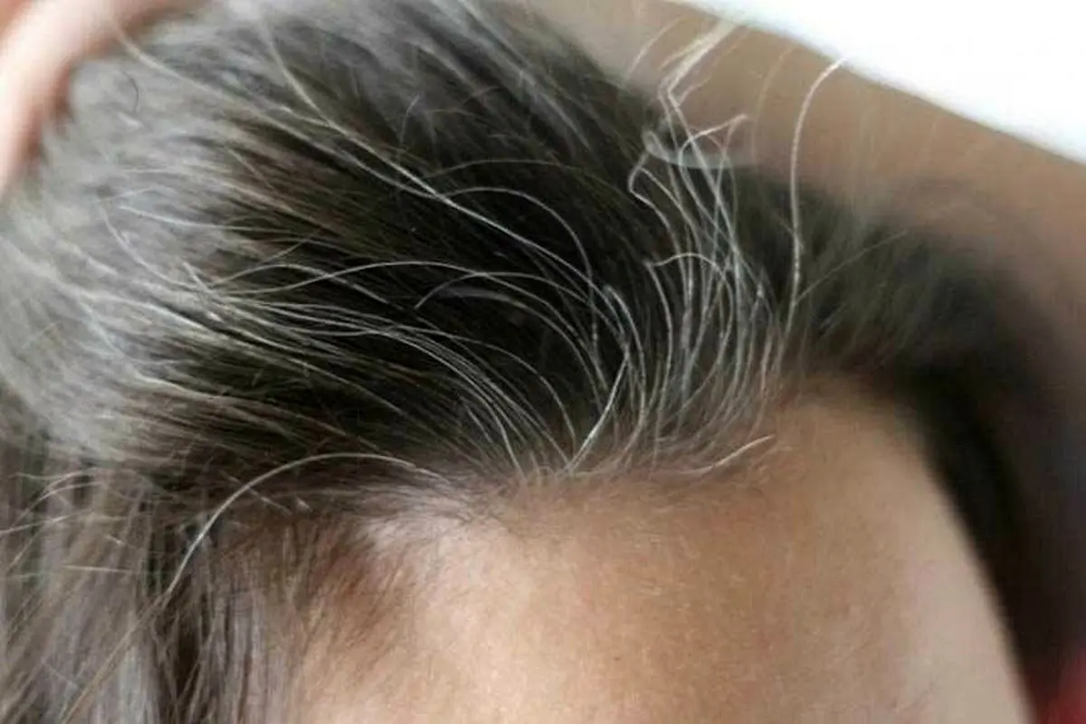  کشف مهم برای جلوگیری از سفیدشدن موها