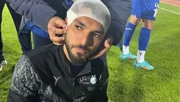 اولین مصدوم دربی مشخص شد / مصدومیت این استقلالی به دلیل پرتاب سنگ از سوی هواداران+تصاویر